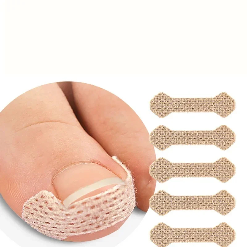 40/100pcs Ingrown Toenail Correction Stickers – Nail Care Patches for Pedicure Treatment & Recovery - Image 2