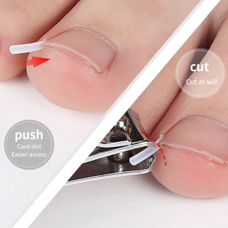 50pcs Ingrown Toenail Correction Tools – Elastic Patch Stickers & Straightening Clip Brace for Pedicure Care - Image 2