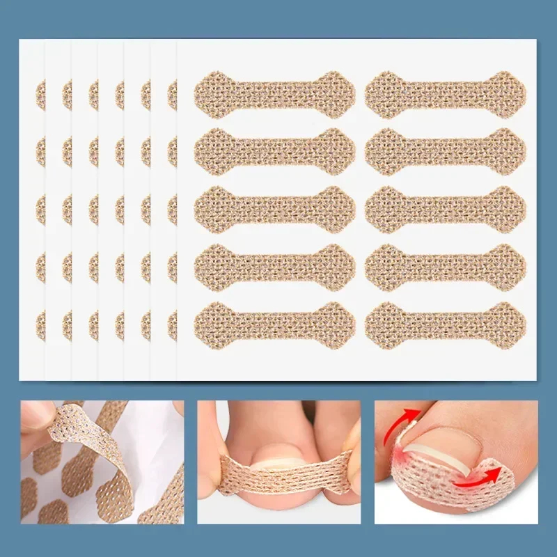 40/100pcs Ingrown Toenail Correction Stickers – Nail Care Patches for Pedicure Treatment & Recovery - Image 4