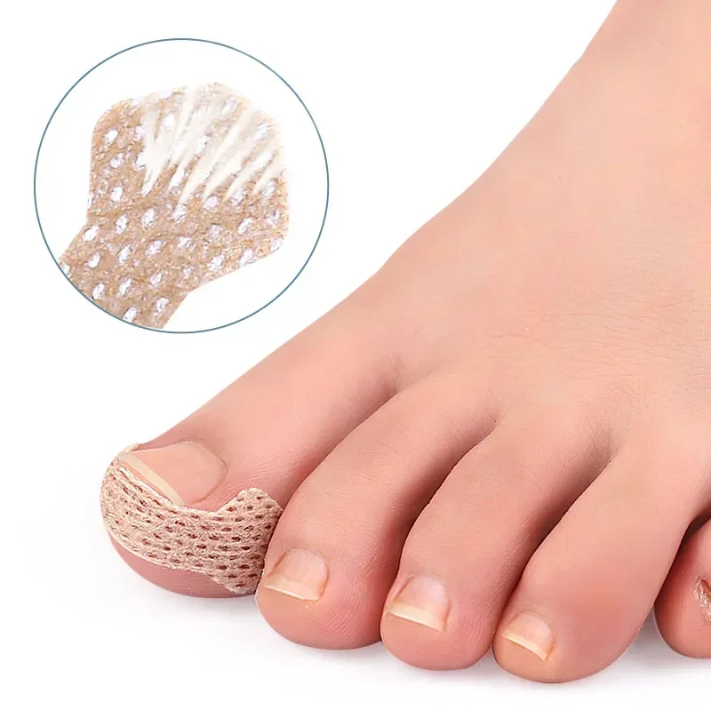 40/100pcs Ingrown Toenail Correction Stickers – Nail Care Patches for Pedicure Treatment & Recovery - Image 5