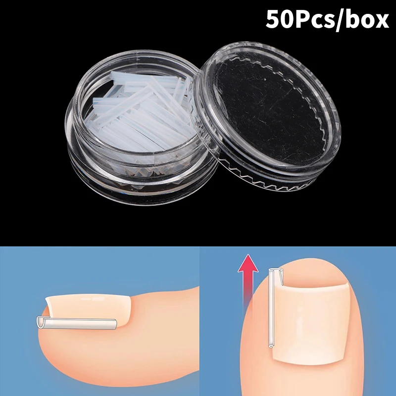 50pcs Ingrown Toenail Correction Tools – Elastic Patch Stickers & Straightening Clip Brace for Pedicure Care - Image 5